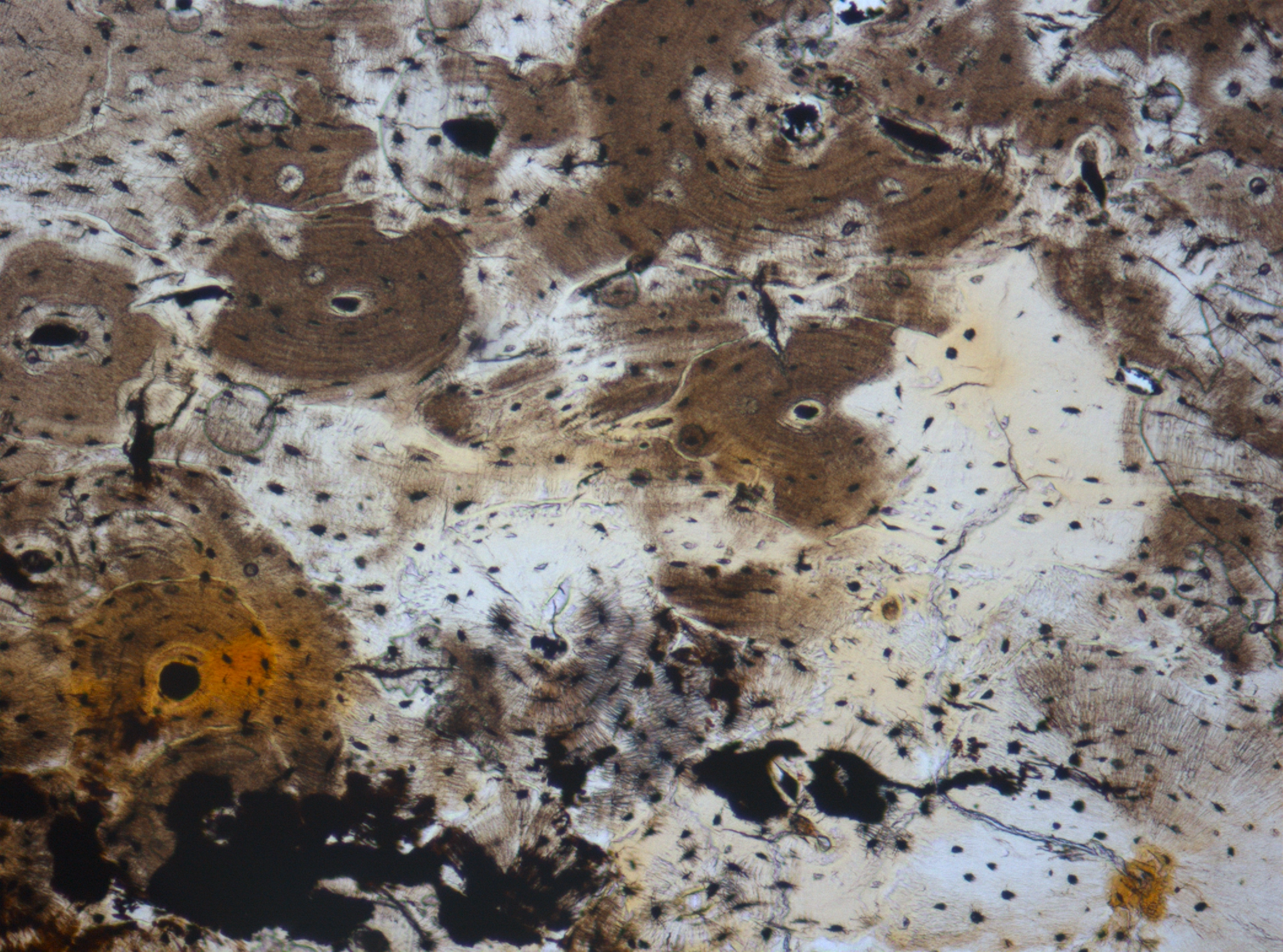 Histotaphonomy of Bones